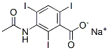 129-63-5,sodium acetrizoate